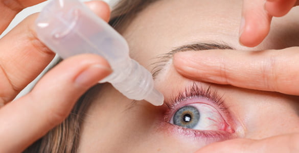 علل خشکی چشم