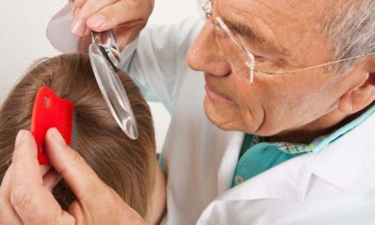 درمان شپش سر