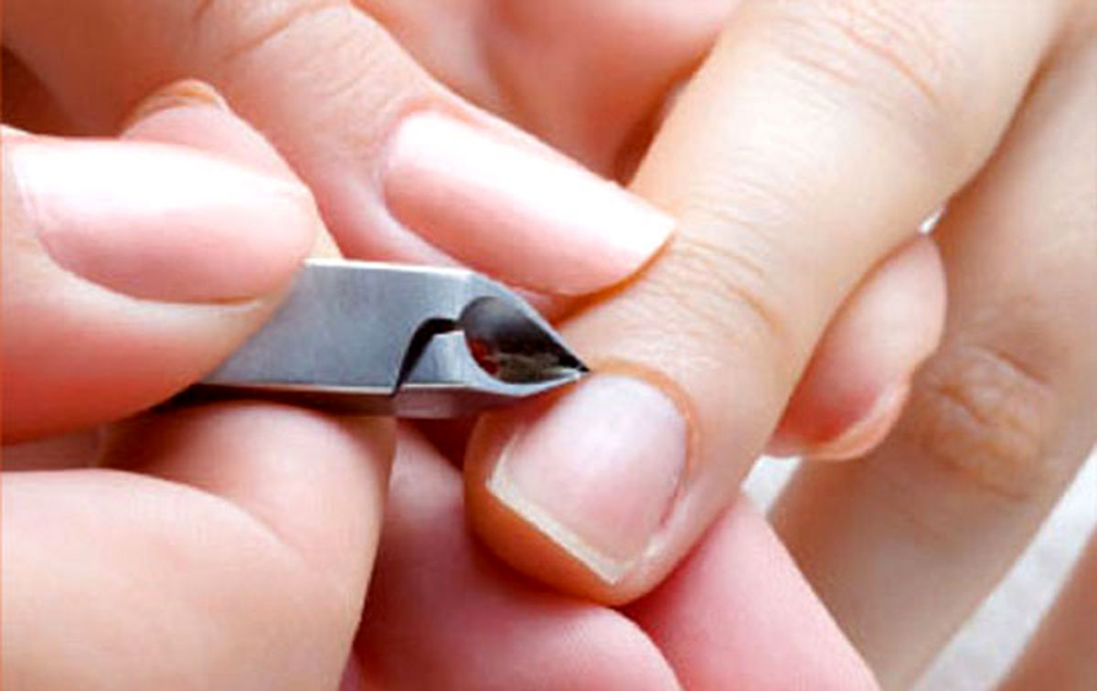 پوسته پوسته شدن ناخن